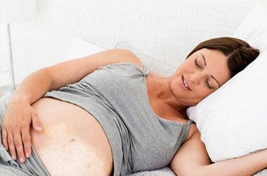 孕妇患者该怎么治疗白癜风呢?